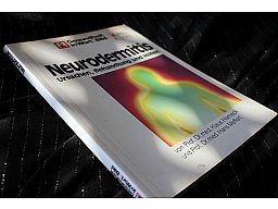 Neurodemitis - Ursachen Behandlung und Hilfen Prof. Dr. med. Klaus Harnack